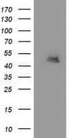 MTFMT Antibody (aa175-389, clone OTI1H1)