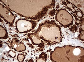 Monoclonal Mouse anti-Human GAPDH Antibody (clone OTI2F8, IHC, WB)