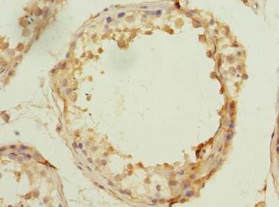 MSTO1 / MST Antibody