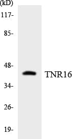 Polyclonal Rabbit anti-Human NGFR / CD271 / TNR16 Antibody (aa101-150, WB)