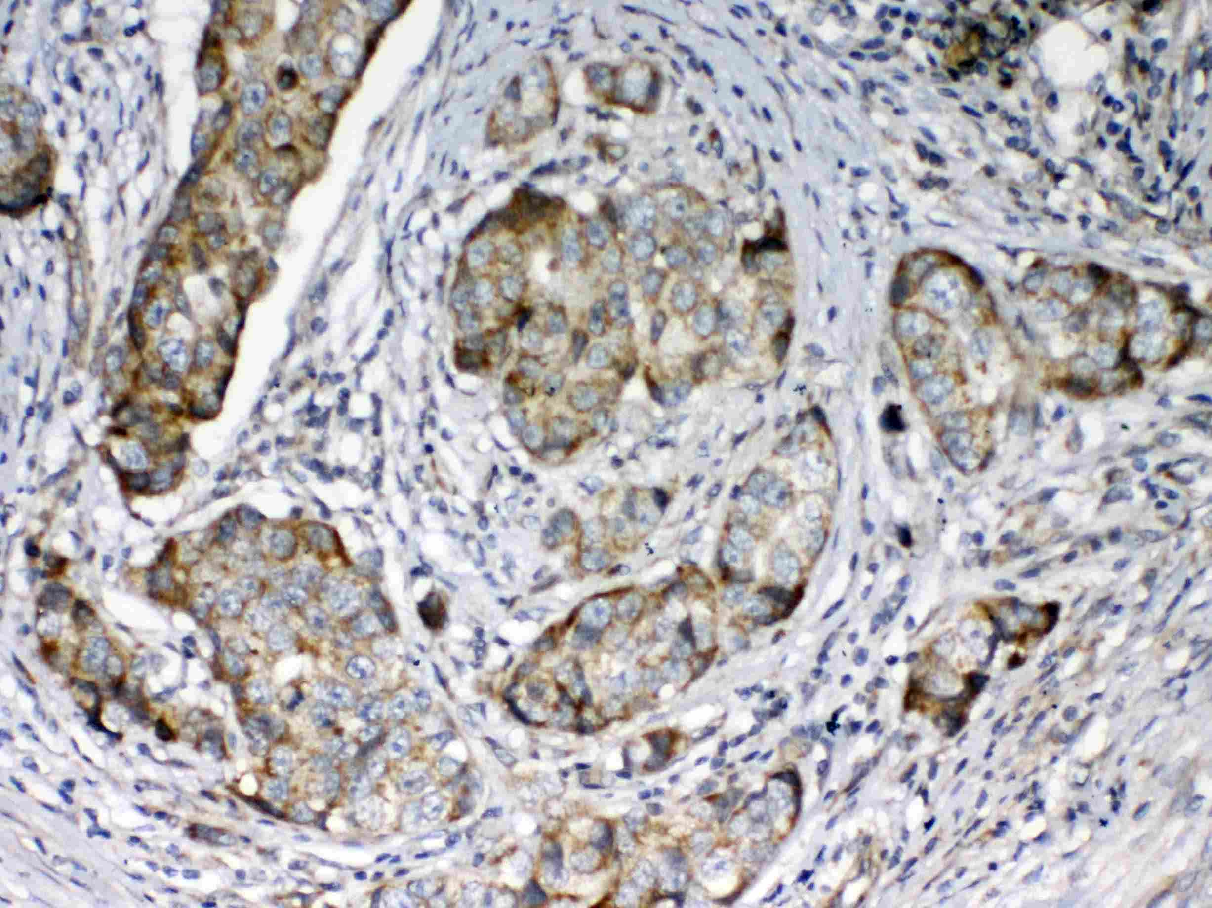 Polyclonal Rabbit anti-Human FZD3 / Frizzled 3 Antibody (IHC, WB)