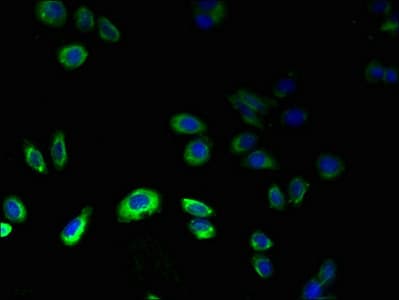 GPR75 Antibody (aa372-540)