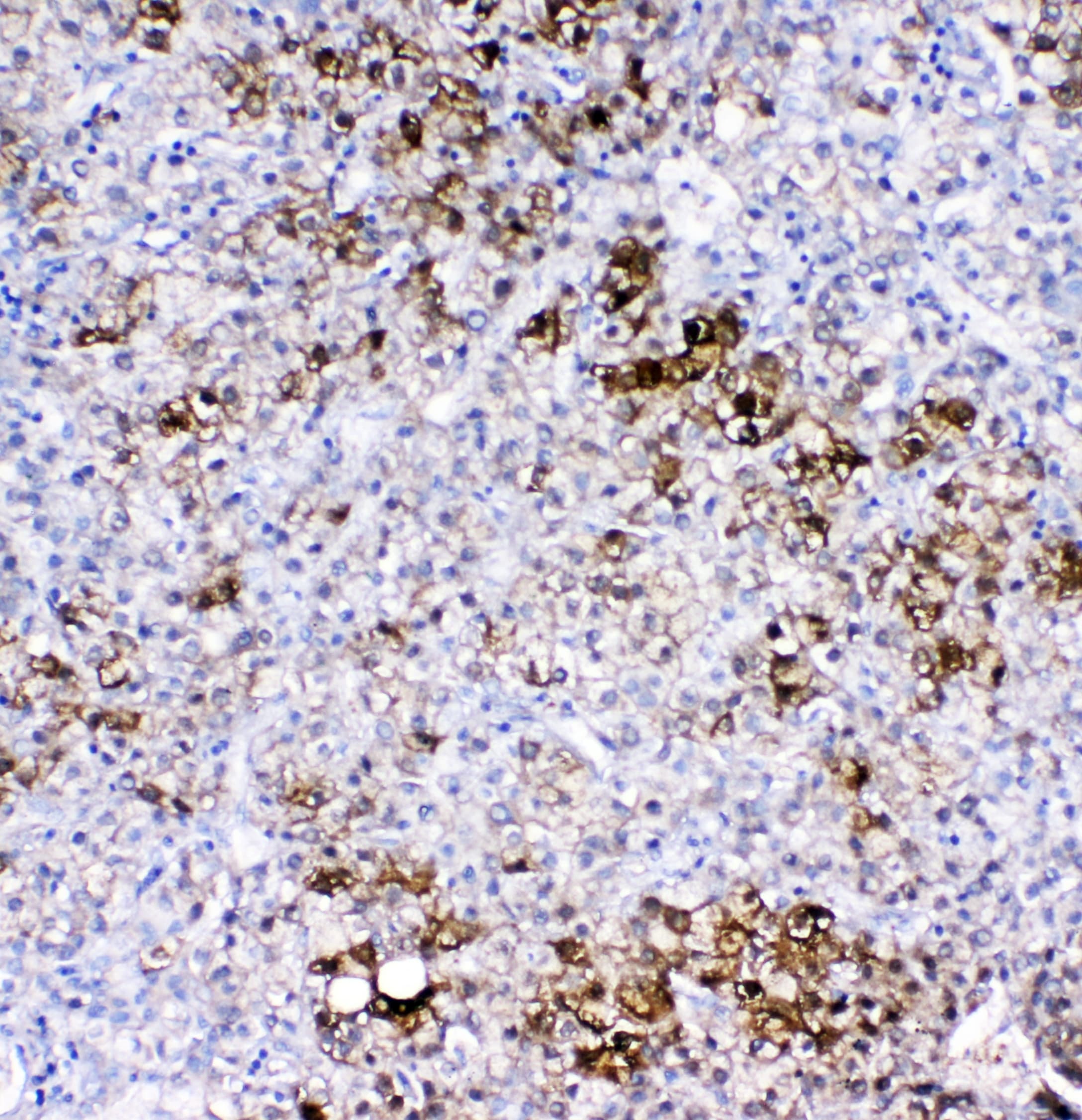 GSTA1+GSTA2+GSTA3+GSTA4+GSTA5 Antibody