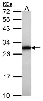 IHC-plus™ Polyclonal Rabbit anti-Human GRB2 Antibody (IHC, WB)