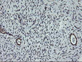 TPD52L3 Antibody (clone OTI3D11, Carrier-free)