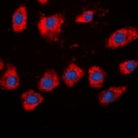 ADD2 Antibody (Internal)
