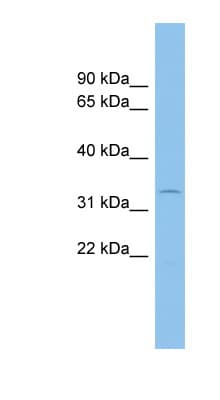 ACP5 / TRAP Antibody (aa71-120)