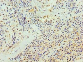 TFPI2 Antibody (aa23-235)