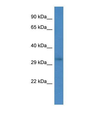 RRM2B / P53R2 Antibody (aa81-130)