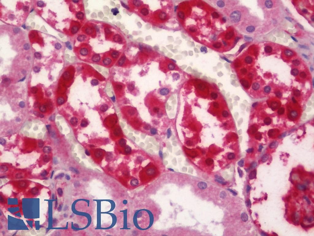 IHC-plus™ CAPN2 / Calpain 2 / M-Calpain Antibody (clone 1F4)