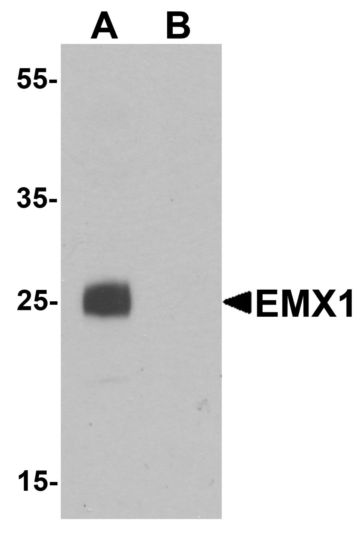 IHC-plus™ EMX1 Antibody