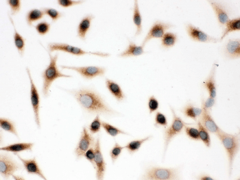 SFTPD / Surfactant Protein D Antibody