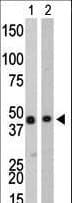 CKB / Creatine Kinase BB Antibody (aa240-270)