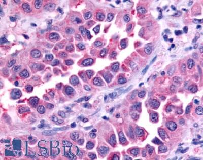 PathPlus™ Polyclonal Rabbit anti-Human GPR45 Antibody (C-Terminus, IHC)
