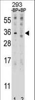 EBI3 / IL-27B Antibody (aa153-181)