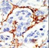 DOK2 Antibody (aa380-412)