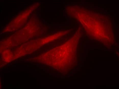 Polyclonal Rabbit anti-Human G3BP1 / G3BP Antibody (phospho-Ser232, IHC, IF, WB)