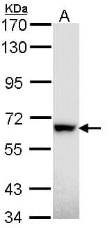 Polyclonal Rabbit anti-Human RAD18 Antibody (aa1-259, IHC, WB)