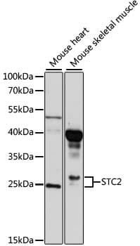Polyclonal Rabbit anti-Human STC2 / Stanniocalcin 2 Antibody (WB)