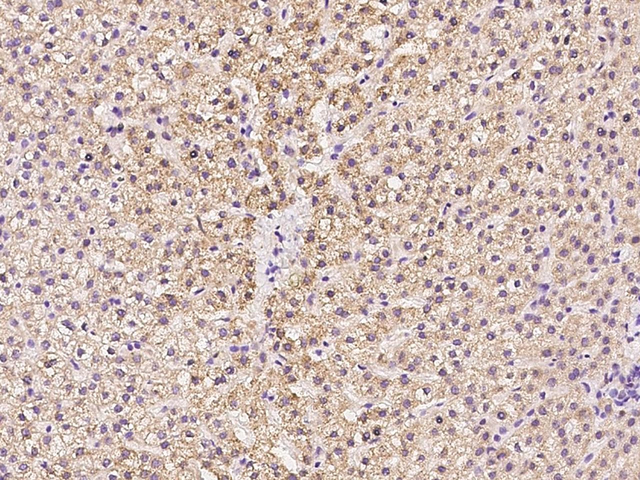 CLEC10A / CD301 Antibody