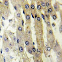 ACAD10 Antibody (Internal)