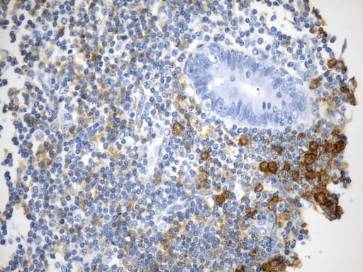 CD38 Antibody (aa43-300, clone UMAB263)