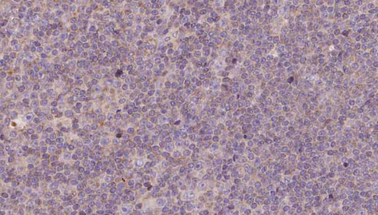 NDUFB11 Antibody