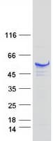 Human TIP49 / RUVBL1 Protein (Recombinant Myc-DDK (Flag))