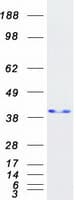 Human NPM1 / NPM / Nucleophosmin Protein (Recombinant Myc-DDK (Flag))