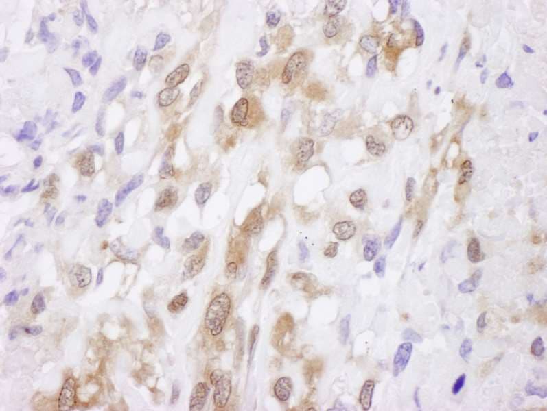 Polyclonal Rabbit anti-Human SOD1 / Cu-Zn SOD Antibody (aa54-104, IHC, WB)