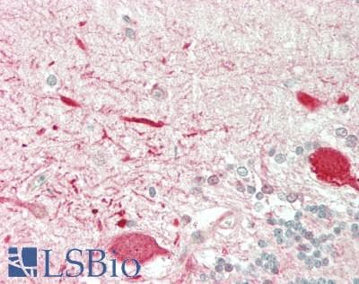 PathPlus™ KCNA1 / Kv1.1 Antibody (aa239-288)