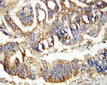 CALB2 / Calretinin Antibody (aa4-18)