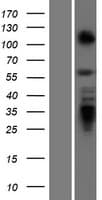 ZBTB7A / Pokemon Protein (Over-Expression Lysate Myc-DDK (Flag))