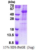 Human TSSK2 Protein (Recombinant His)