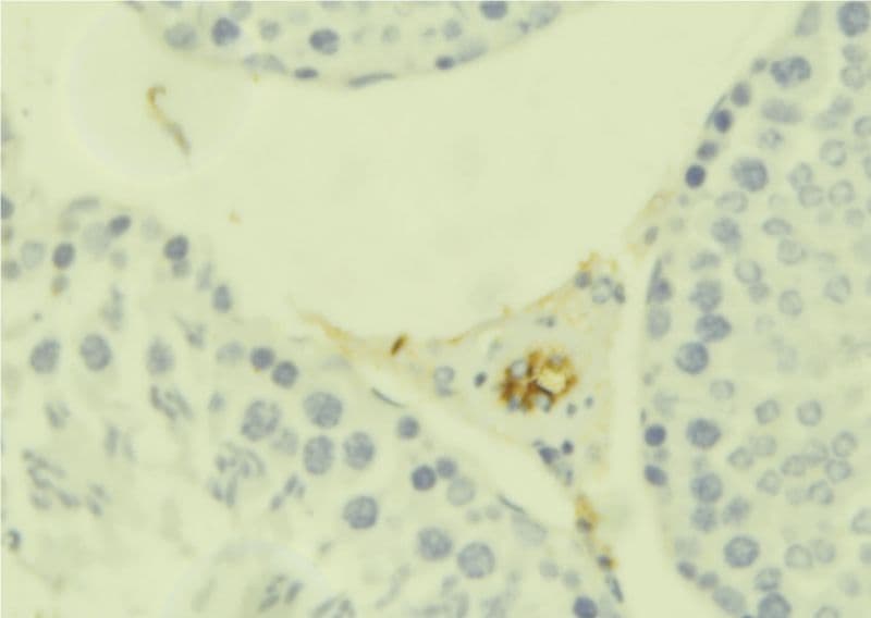 Polyclonal Rabbit anti-Human IL1RL1 Antibody (IHC, WB)