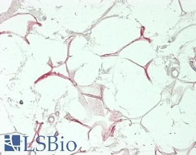 IHC-plus™ FASN / Fatty Acid Synthase Antibody (Internal)