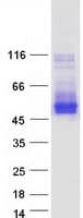 Human TMEM51 Protein (Recombinant Myc-DDK (Flag))