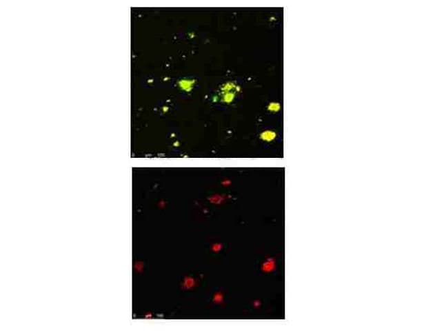 APP / Beta Amyloid Precursor Antibody (Pyro-Glu3)