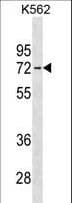 IL22RA1 / IL22R Antibody (aa408-436)