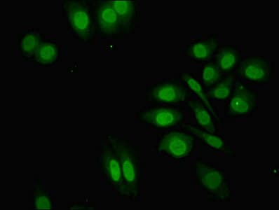Polyclonal Rabbit anti-Human ZNF529 Antibody (WB)