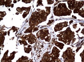 NME1 / NM23 Antibody (clone OTI4H2)