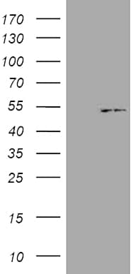 KRT18 / CK18 / Cytokeratin 18 Antibody (aa69-372, clone OTI10G8)