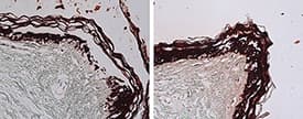 Cytokeratin 1+5+10+14 Antibody (clone 34βE12, Ready-to-Use)