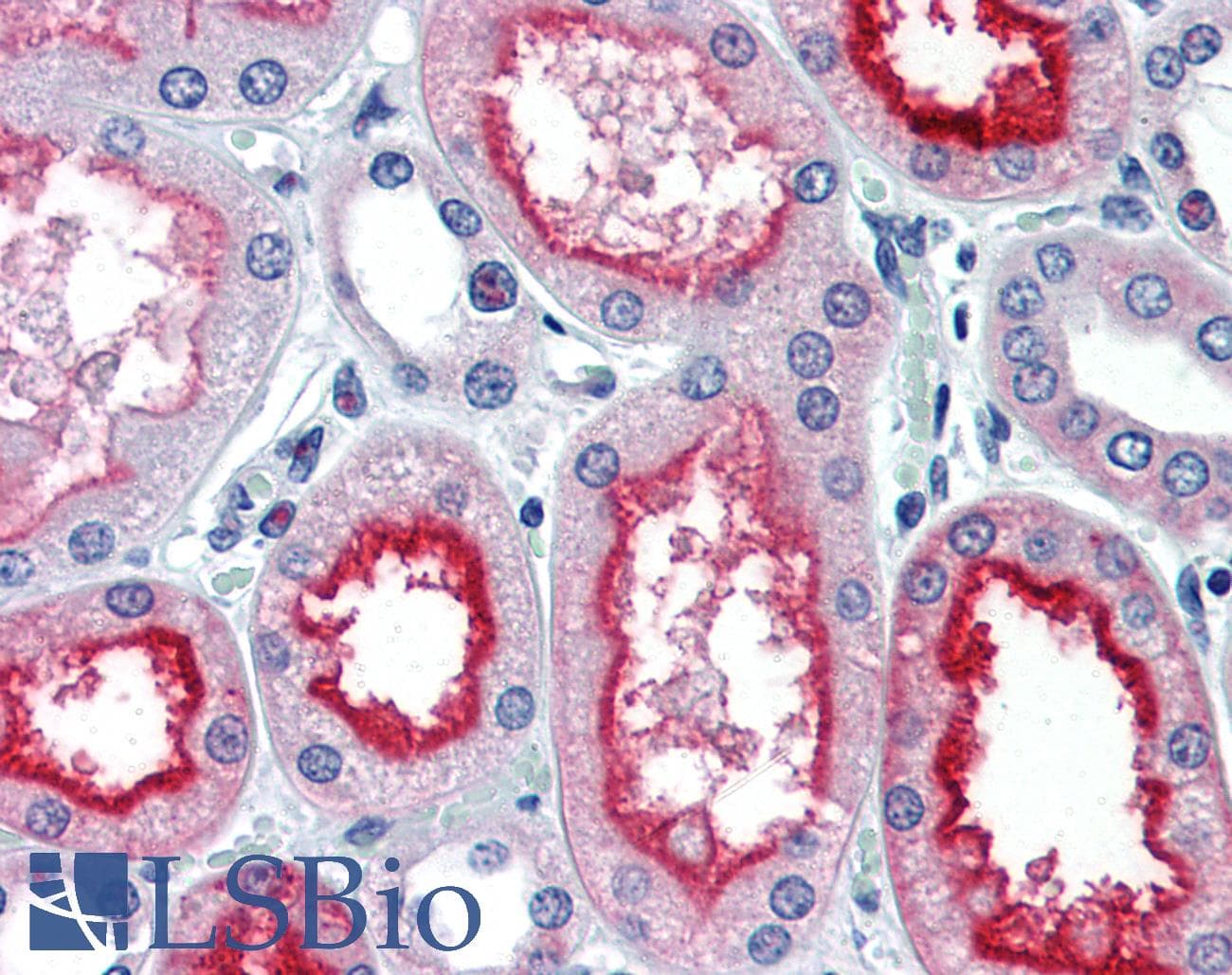 PathPlus™ ACE / CD143 Antibody