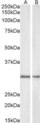 IHC-plus™ NQO1 Antibody (aa263-274)