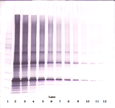 IHC-plus™ Polyclonal Rabbit anti-Human Adiponectin Antibody (IHC, WB)