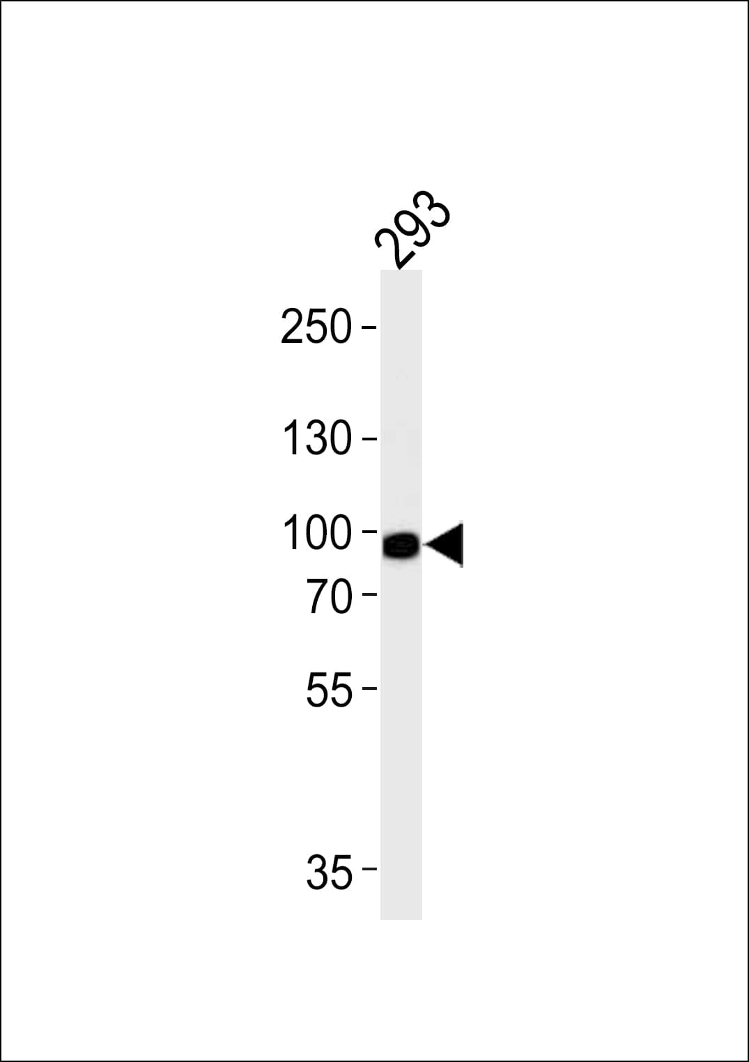 PLA2G4A Antibody (aa513-541)