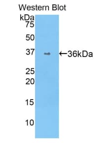 F5 / Factor Va Antibody (aa1908-2203, Biotin)