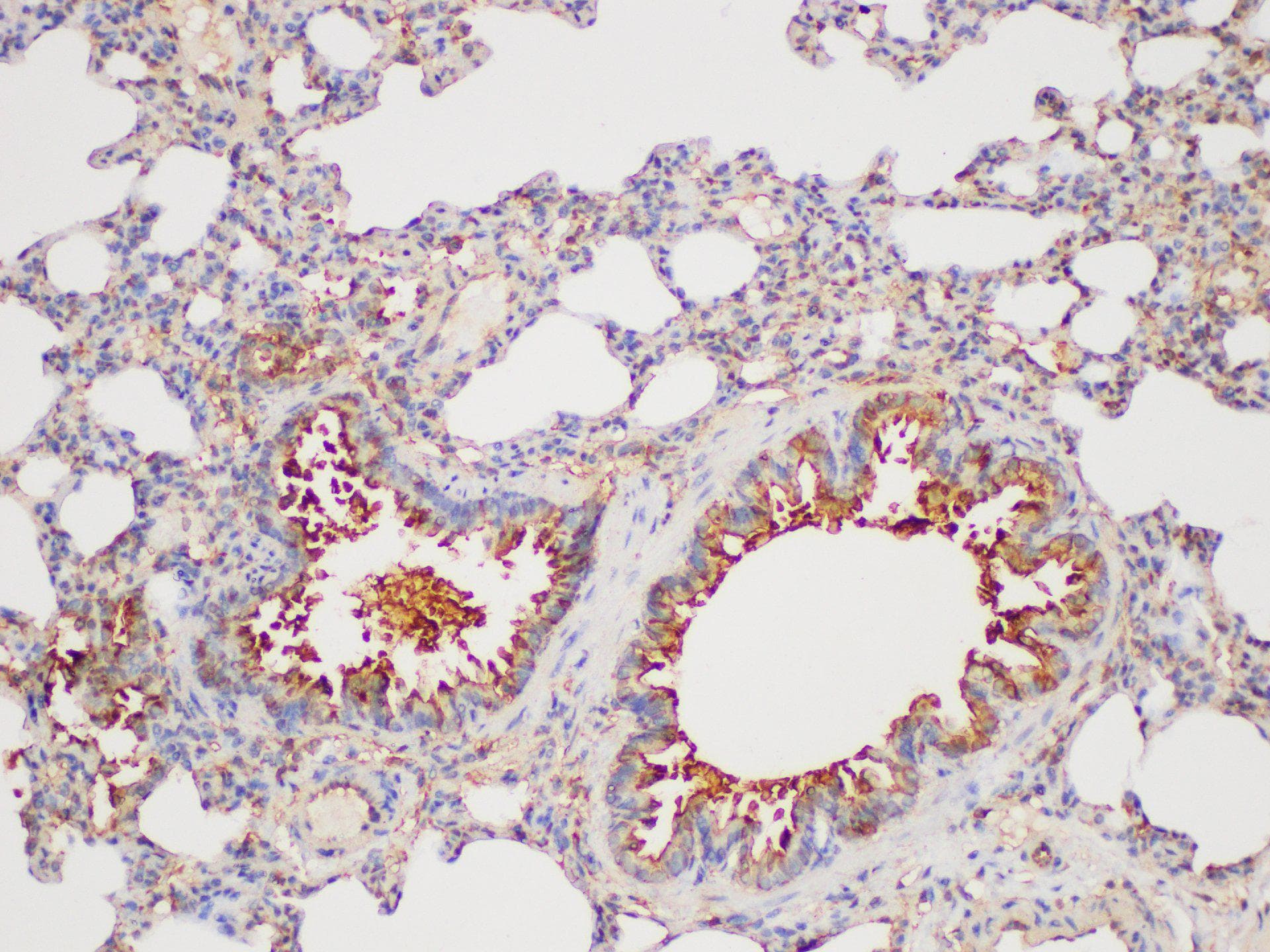 Polyclonal Rabbit anti-Mouse GSTP1 / GST Pi Antibody (IHC, WB)