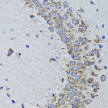 PTP1B Antibody